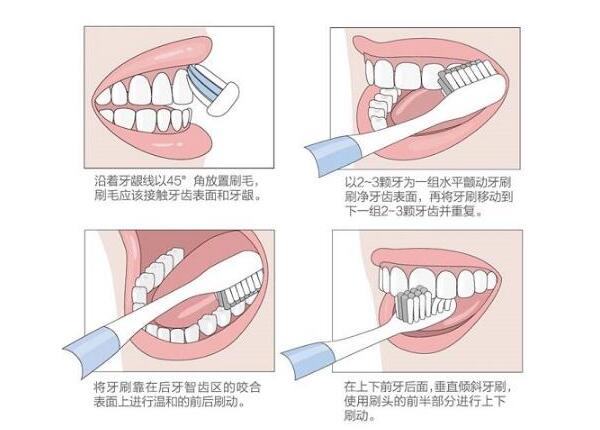 圓頭聲波電動牙刷刷牙方法之巴氏刷牙法